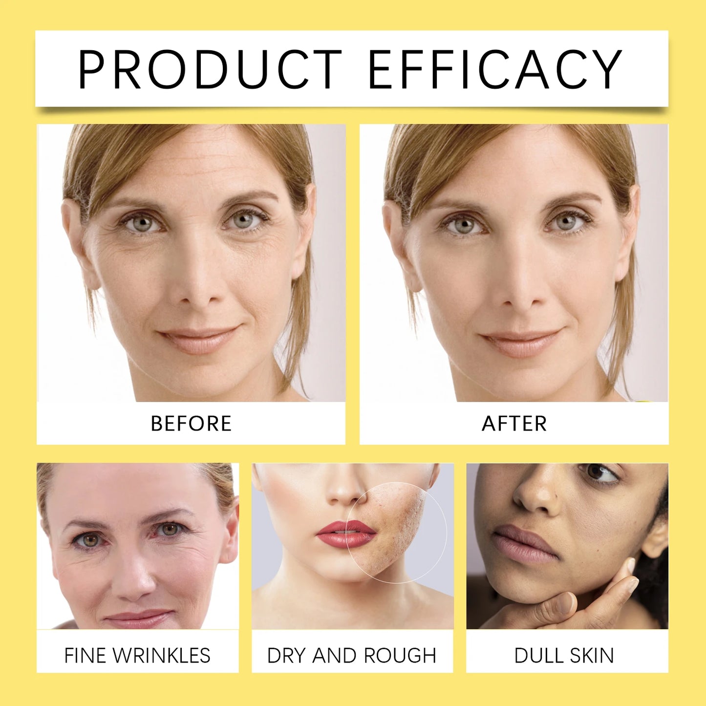 Snail 92 All In One Cream - Hydrating & Firming Face Moisturizer